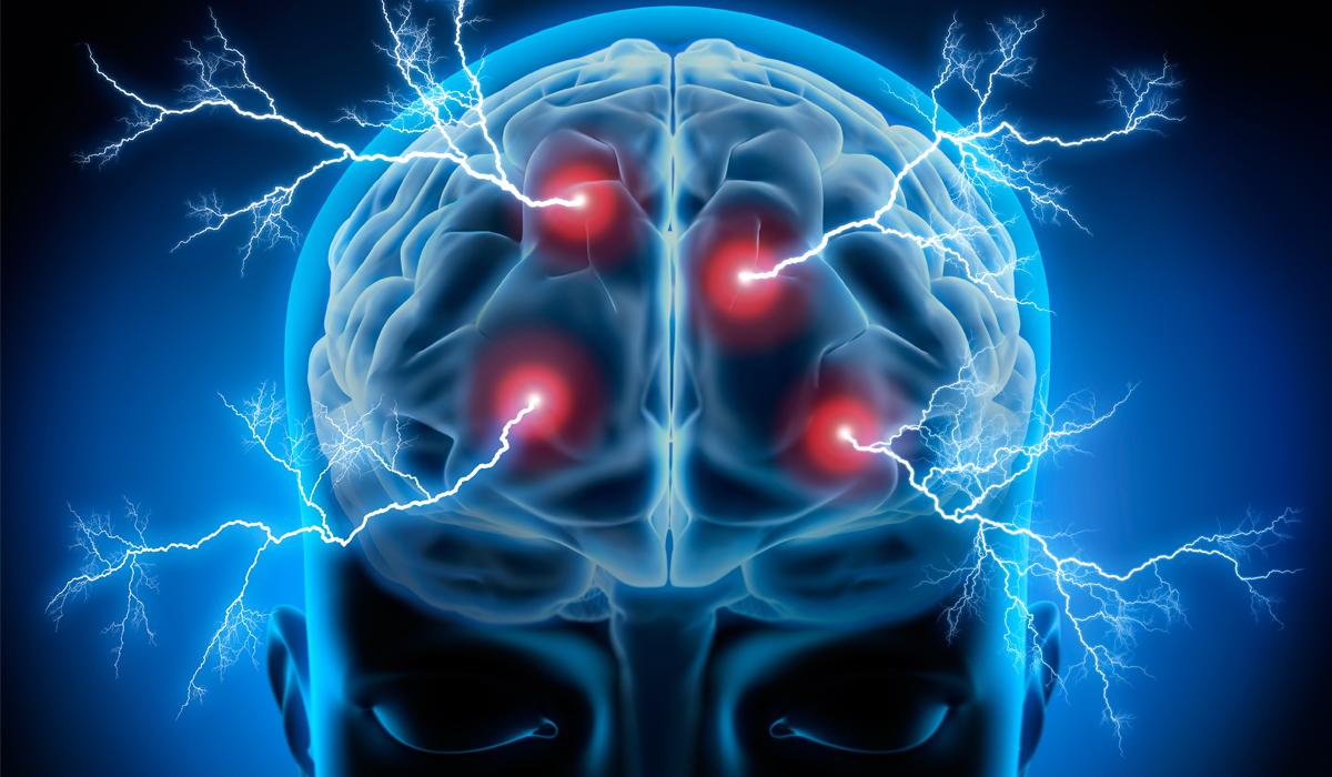 Neuroventas | Del charlatán a la resonancia magnética